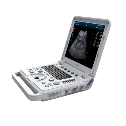 VET Tier ärztliche tragbare Ultraschall-Scanner Laptop-Maschine Farb doppler für Schwangerschaft bei Tieren