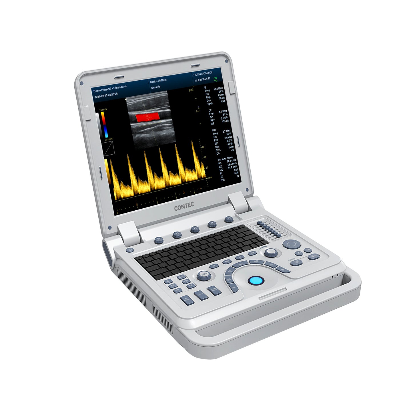 VET Tier ärztliche tragbare Ultraschall-Scanner Laptop-Maschine Farb doppler für Schwangerschaft bei Tieren