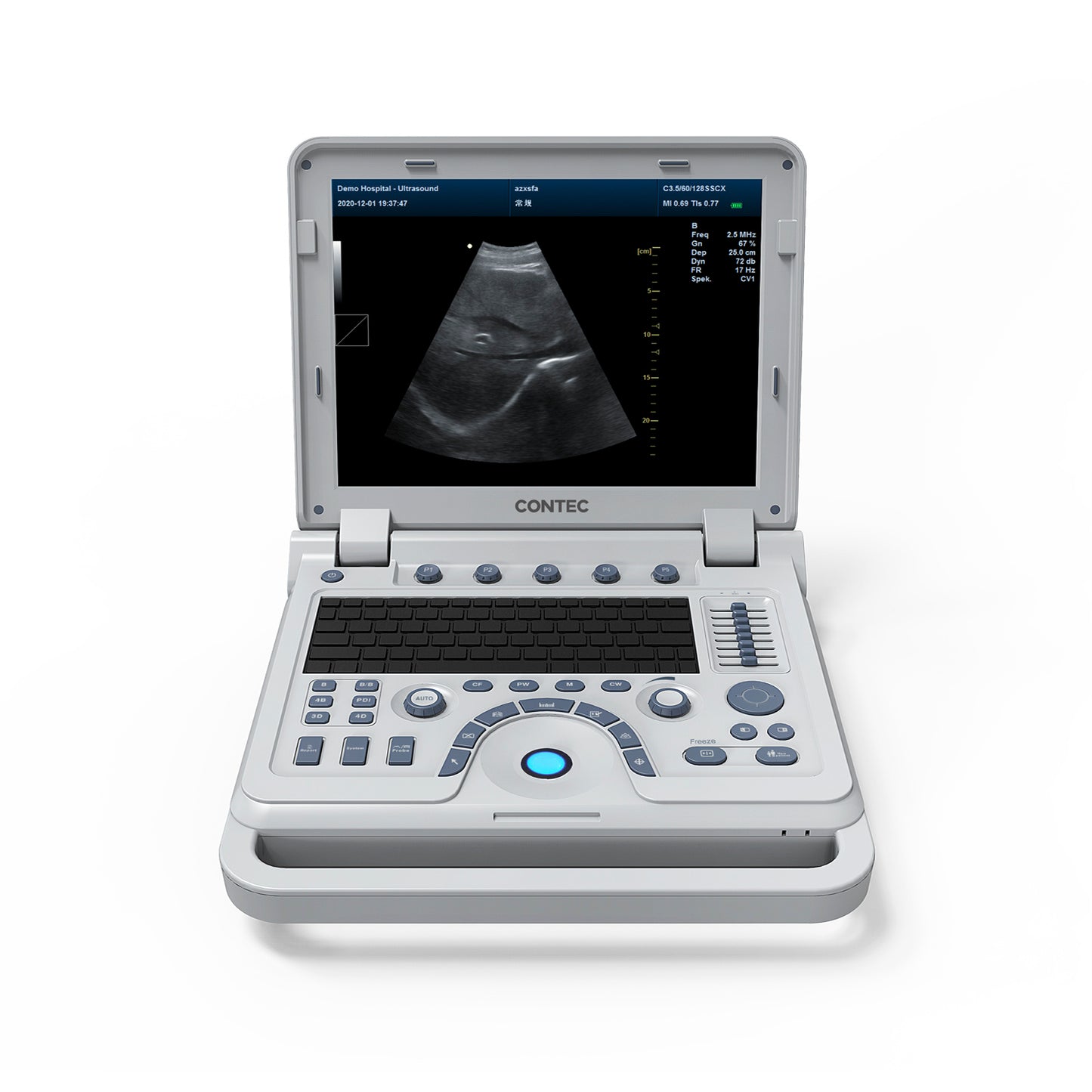 VET Tier ärztliche tragbare Ultraschall-Scanner Laptop-Maschine Farb doppler für Schwangerschaft bei Tieren